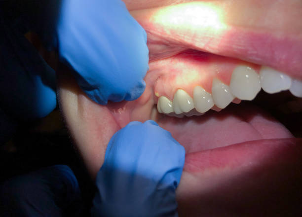 Best Mobile Emergency Dentist in Sanger, TX